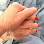 arthritic elderly hands